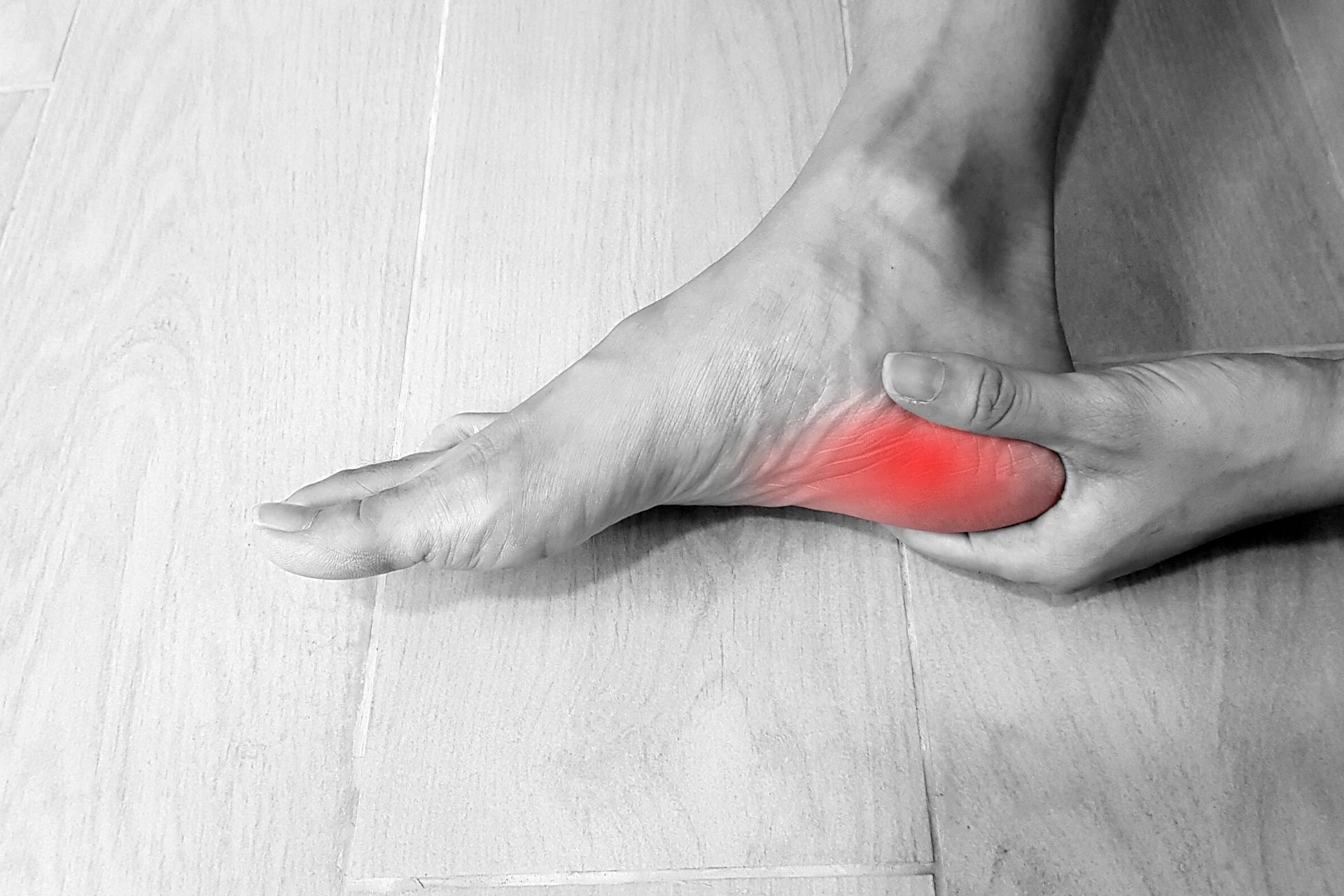 Plantar Fasciitis